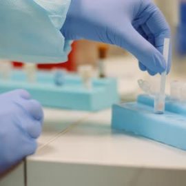 Videohive Positive Test of Corona Virus at Laboratory (Stock Footage) Free Download