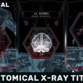 Videohive Anatomical X-Ray Titles Vertical 42887575 Free Download
